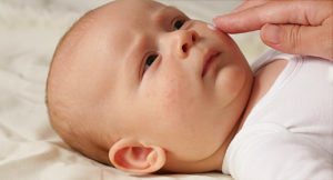 宝宝长了湿疹怎么办？这3个护理方法，家长们该学会